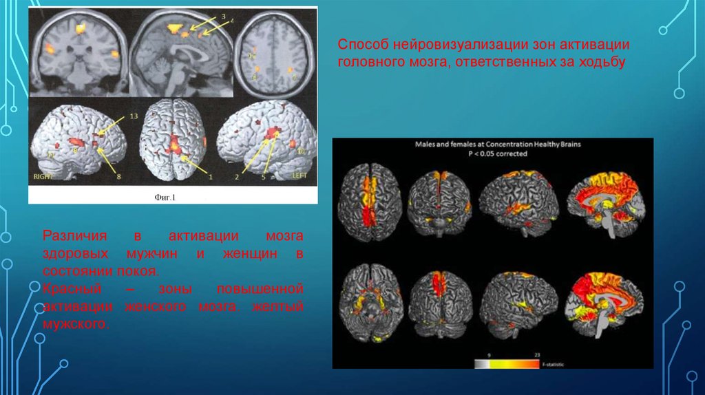 Образование головного мозга. Нейровизуализация мозга. Способы активизации мозга. Активация головного мозга. Активатор мозга.