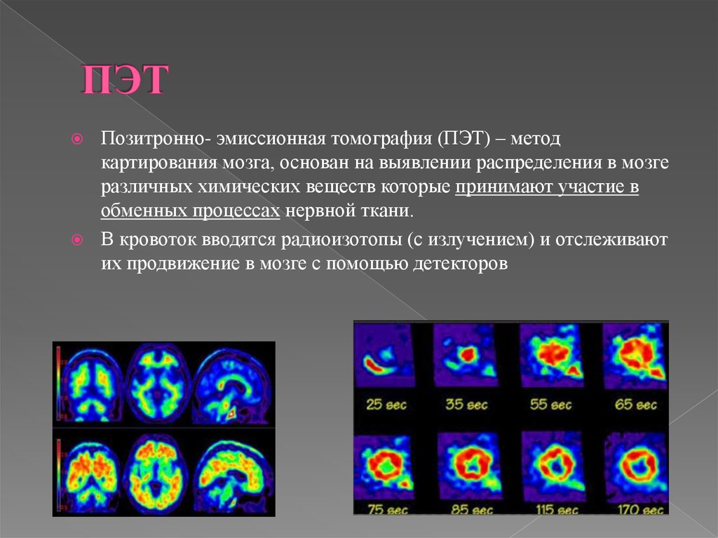 Методы позитронно эмиссионной томографии