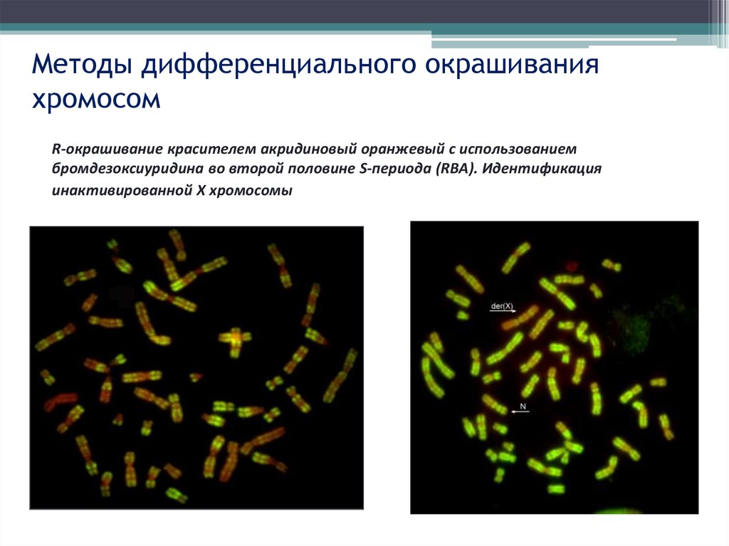 Хромосомы определяют окраску растения. Метод дифференциальной окраски хромосом. Кариотип методом дифференциальной окраски хромосом. G-метод дифференциального окрашивания. Дифференциальная окраска хромосом.