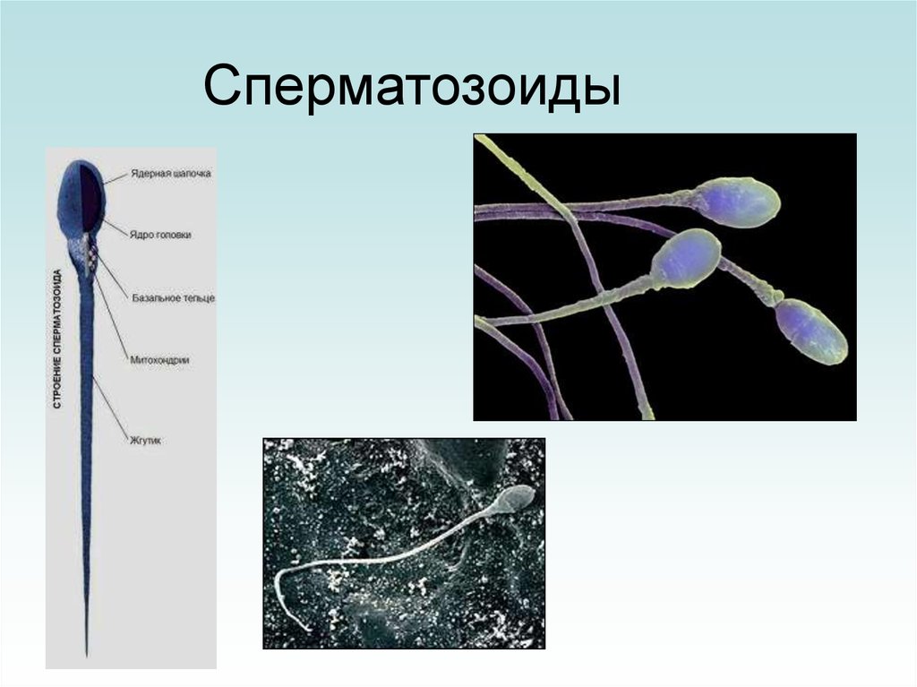 Хромосомы спермия