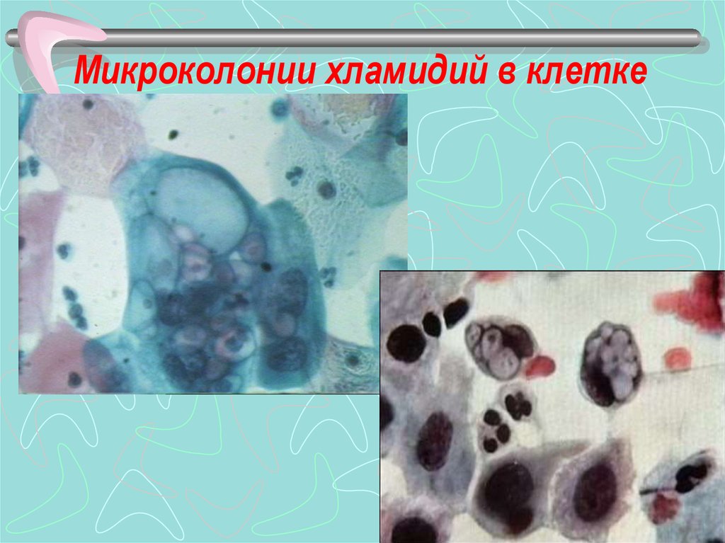 Риккетсии хламидии микоплазмы. Микроколонии хламидий. Хламидии как выглядят