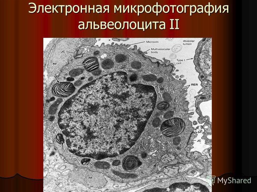 Рассмотрите световую микрофотографию. Альвеолоциты 1 типа функции. Альвеолоциты 2-го типа. Пневмоцит 2 типа гистология. Электронная микрофотография.