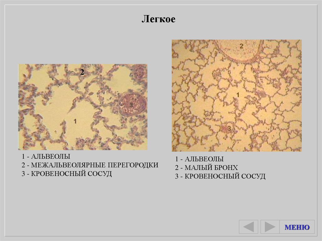 Легкое препарат. Легкое гистология строение. Легкое альвеолы препарат гистология. Легкие гистология препарат. Препарат легкого гистология.