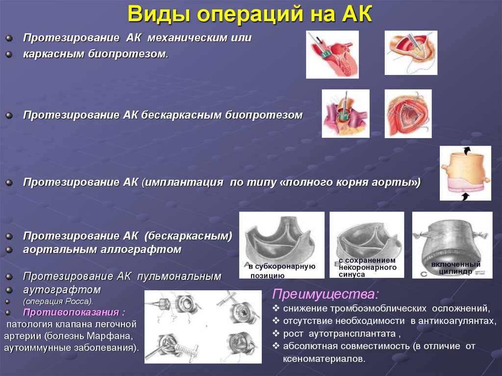 Механические операции виды