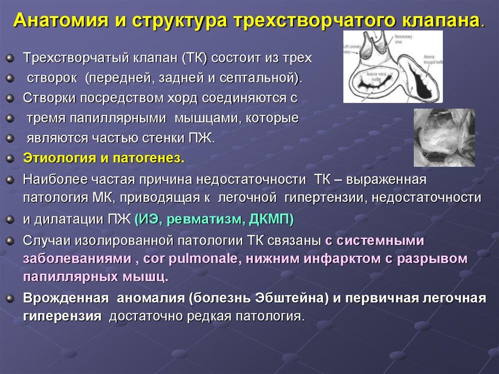 Недостаточность трехстворчатого клапана рисунок