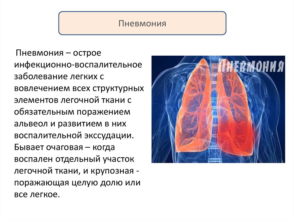 Физиотерапия при пневмонии презентация