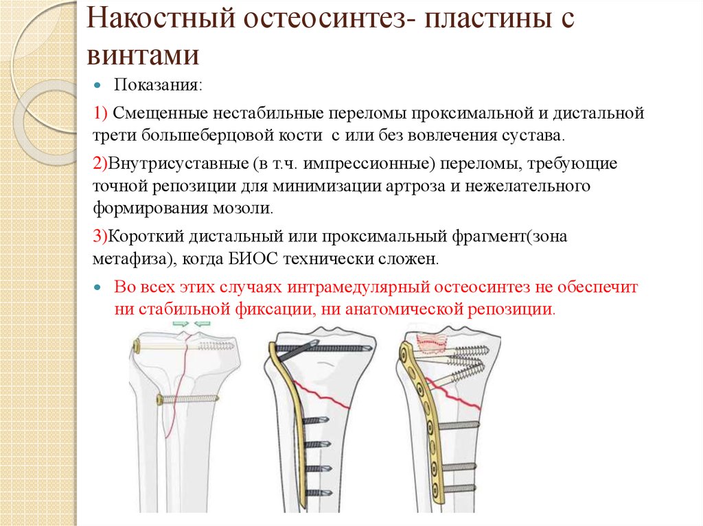 Перелом большеберцовой кости карта вызова смп