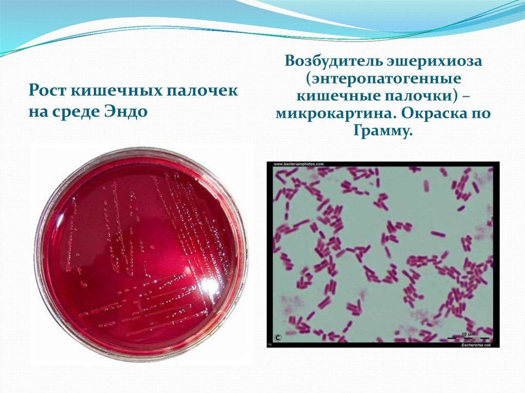 Возбудитель. Эшерихии в среде Эндо микробиология. Колибактериоз на среде Эндо. Рост кишечной палочки на среде Эндо. Рост БГКП на среде Эндо.