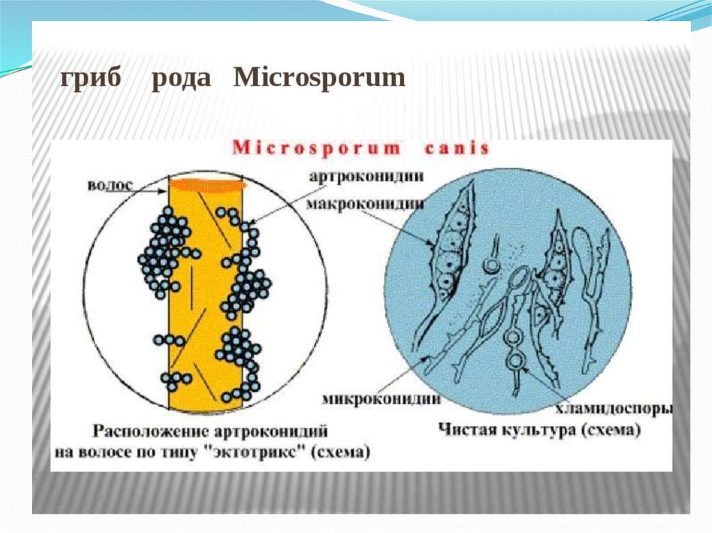 Microsporum canis. Плесневый грибок рода Microsporum. Грибы рода микроспорум. Грибом Microsporum canis. Микроспорум Канис микроскопия.