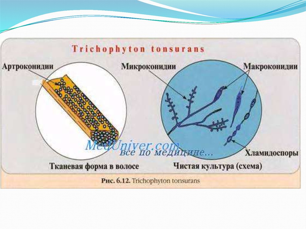 Тип поражения волос endothrix картинка