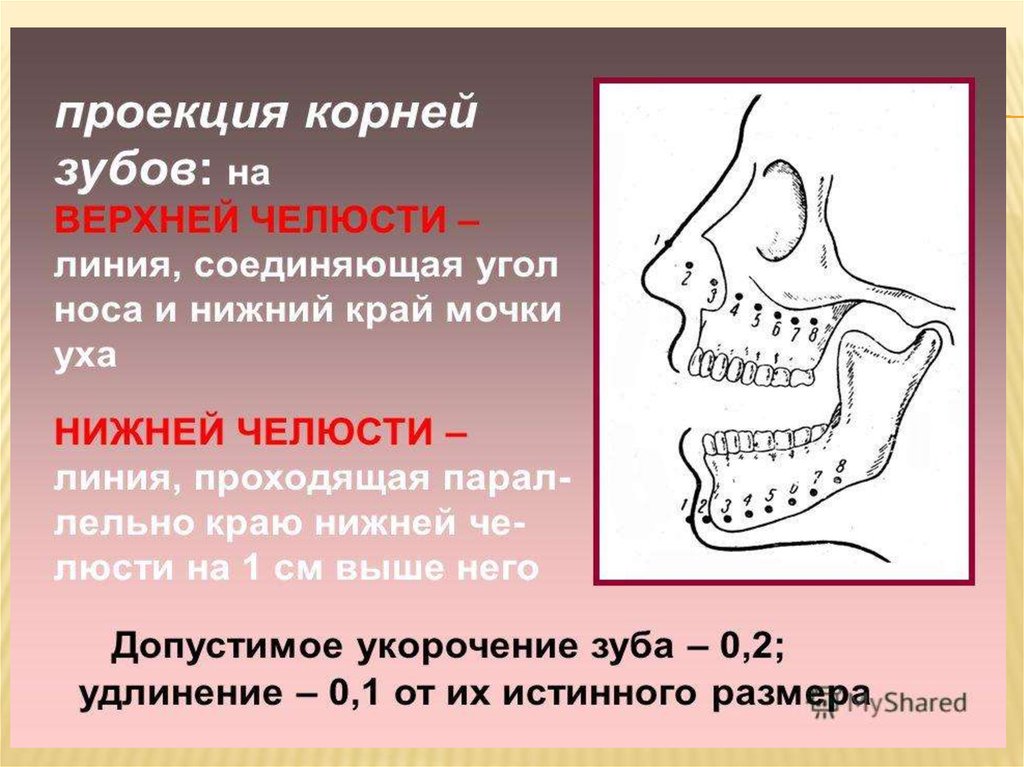 Нижний край нижней челюсти. Корни зубов Нижнего челюста. Корни зубов верхней челюсти. Расположение зубов в челюсти.