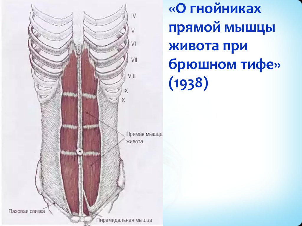 Прямая мышца где. Пирамидальная мышца живота функции. Пирамидальная мышца живота анатомия. Pyramidalis мышца. Надрыв прямой мышцы живота.