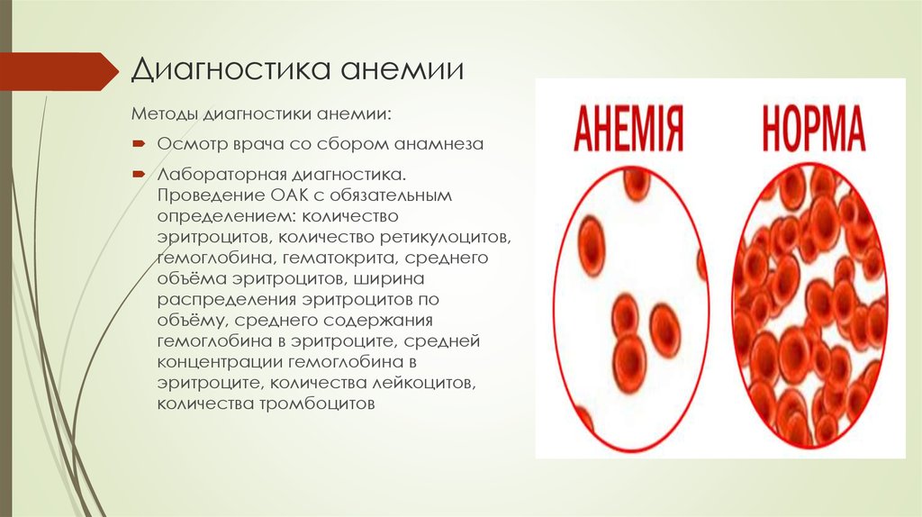 Виды анемии. Методы диагностики железодефицитной анемии. Инструментальная диагностика железодефицитной анемии. Методы исследования при анемии. Методы выявления анемий.