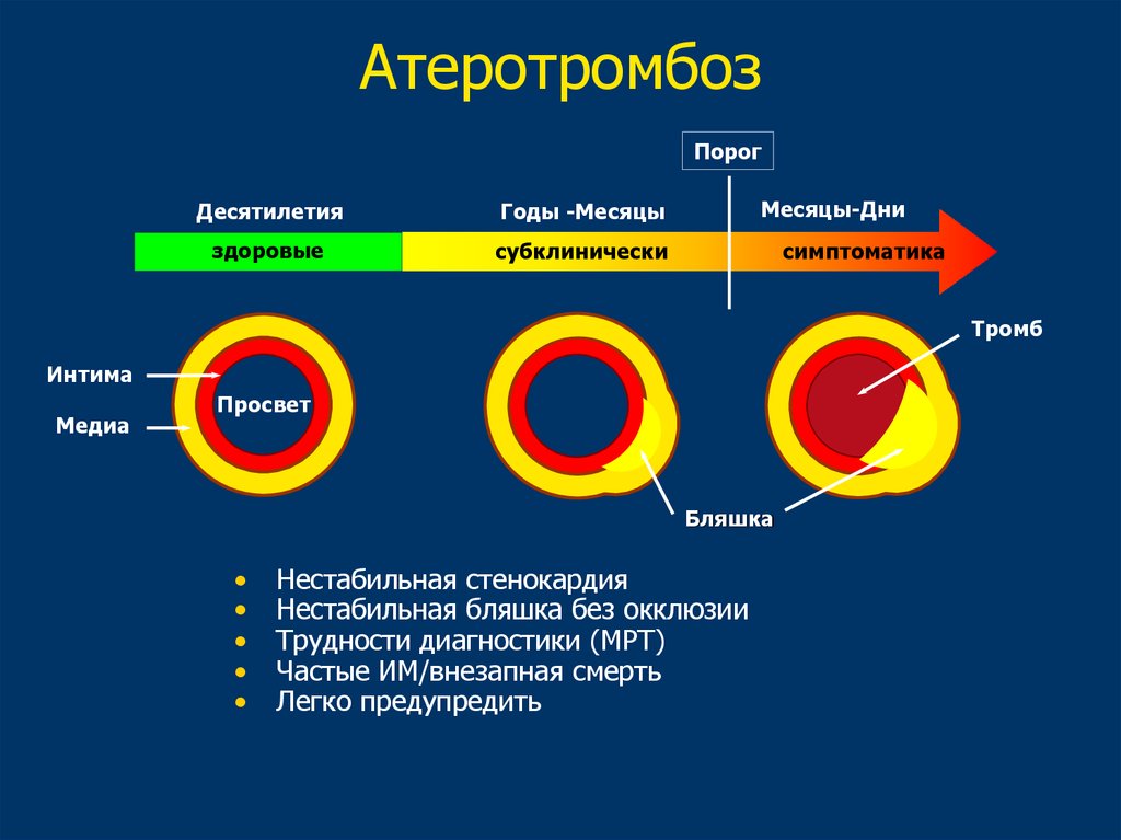 Стабильная и нестабильная бляшка. Механизм атеротромбоза. Стабильная и нестабильная бляшка отличия. Атеросклероз или Атеротромбоз разница.