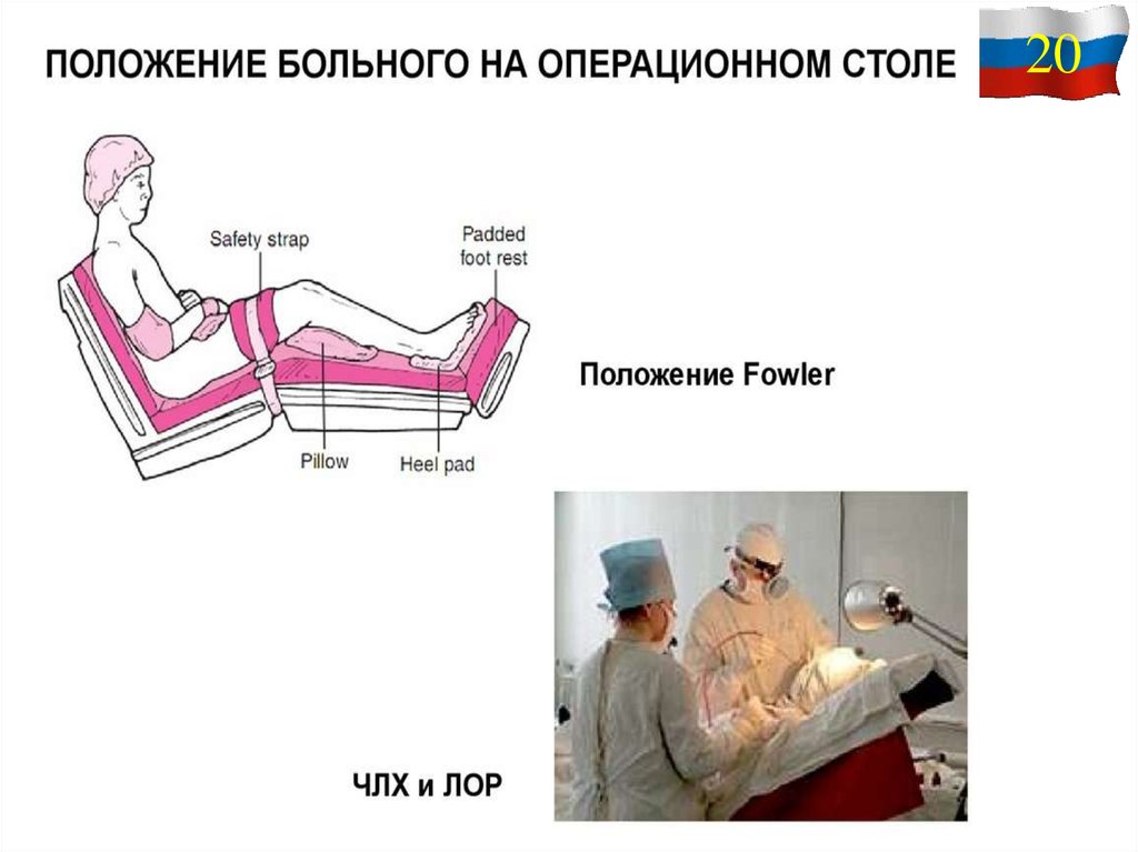 Положение на операционном столе при различных операциях