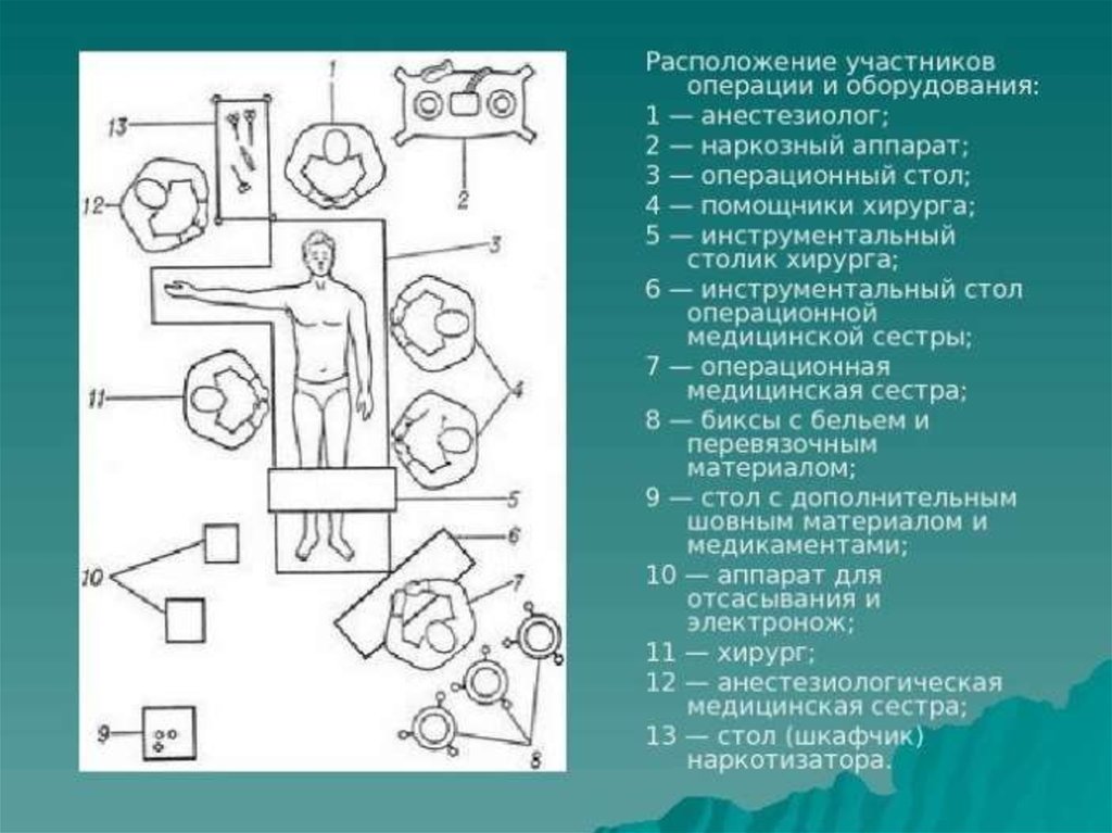 Участвовала в операции. Схема перевязочной расположение инструментов на стерильном столе. Расположение инструментов на операционном столе. Операционная схема. Расположение операционной бригады.