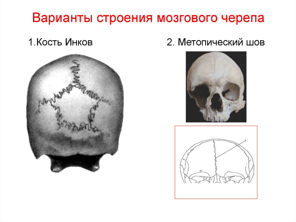 Швы лобной кости