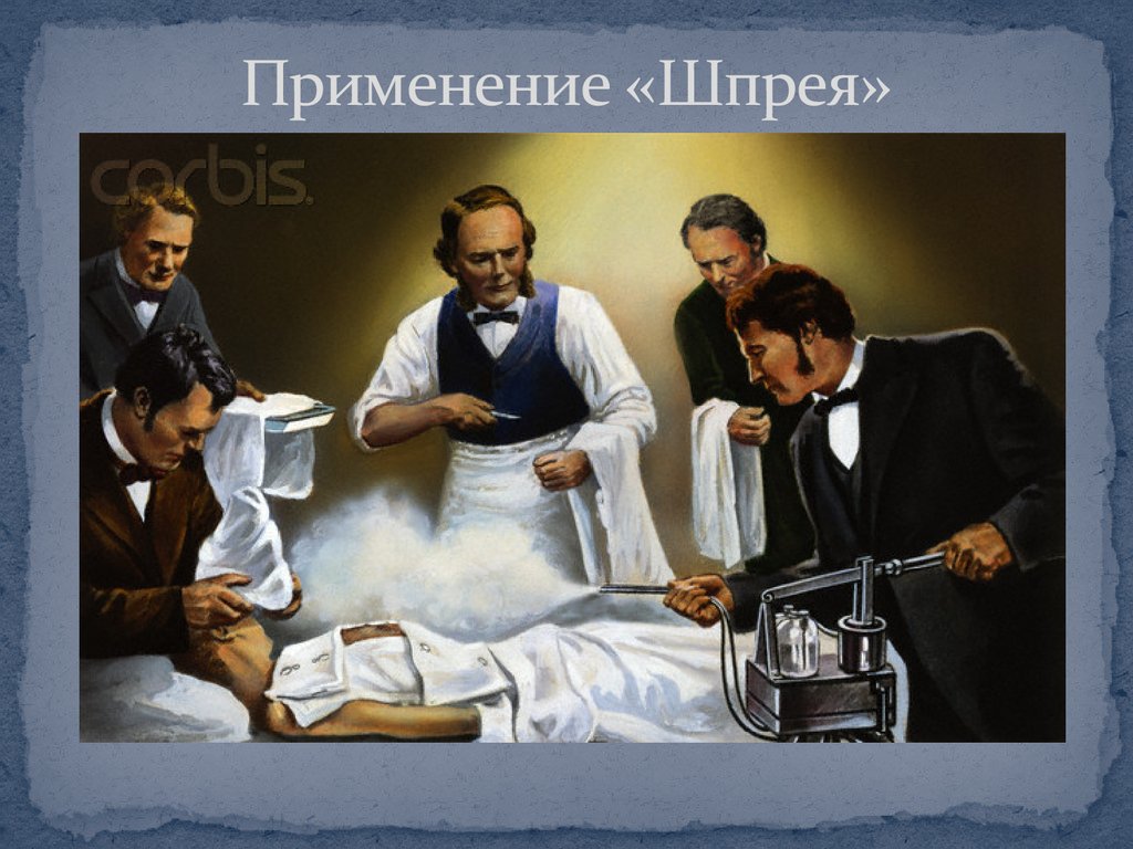 Применение «Шпрея»