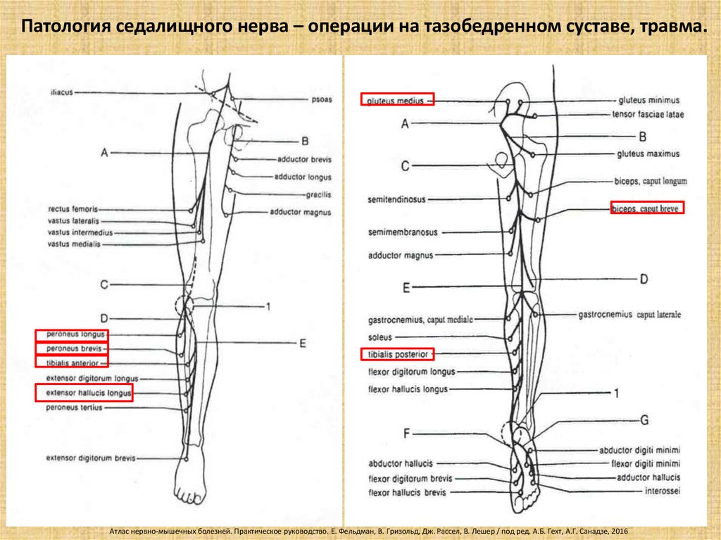 Неврологические боли в ногах. Седалищный нерв анатомия схема. Седалищный нерв анатомия топография. Sedalishni Nerv vetvi. Двигательные волокна седалищного нерва.
