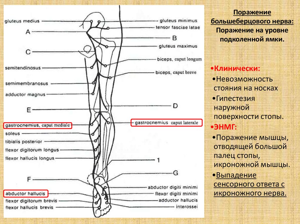 Нервы ноги. Нервная система нижних конечностей человека анатомия. Анатомия нервов нижних конечностей схема. Большеберцовый нерв иннервирует мышцы. Большеберцовый нерв иннервация.