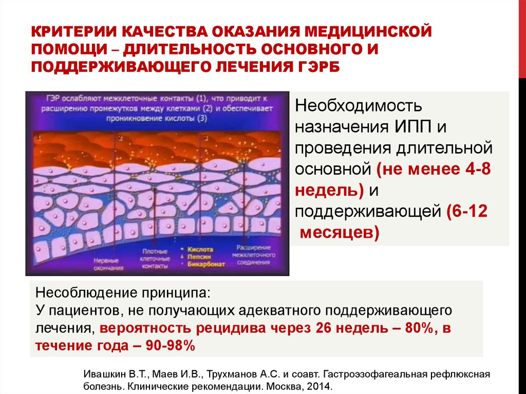 Ингибиторы протонной помпы при гэрб