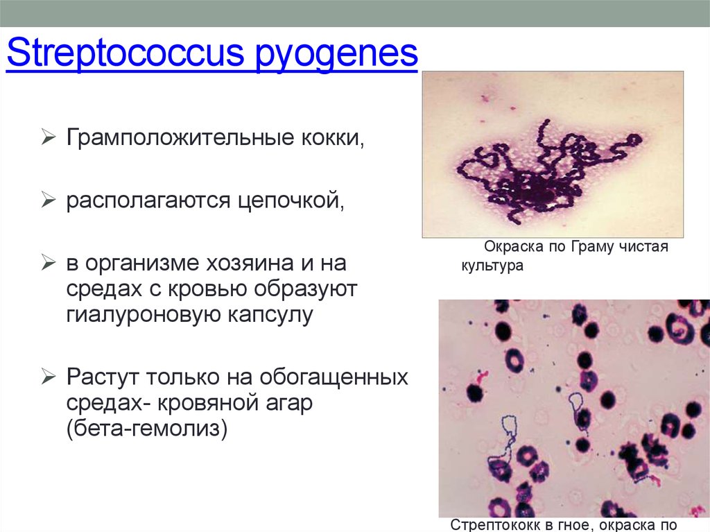 Streptococcus pyogenes