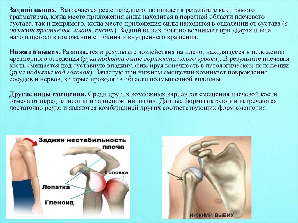 Операция на плечевом суставе