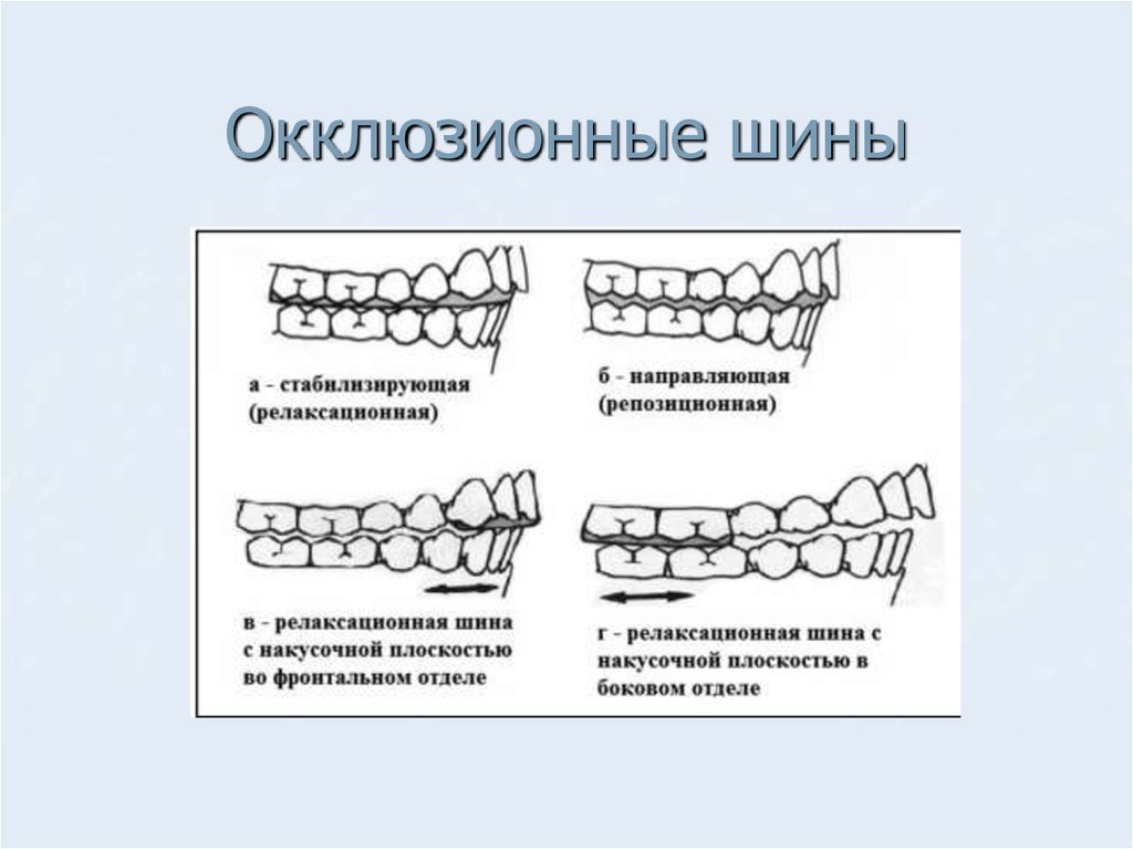 Наложение сложных шин и шин протезов реабилитация больных пародонтитом презентация