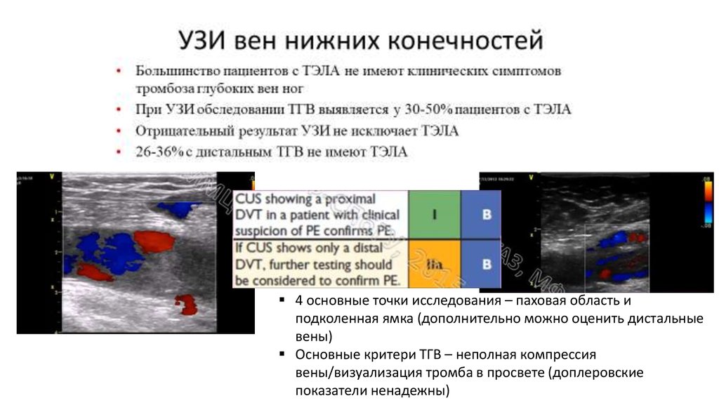 Венозная компрессия. Визуализация вен УЗИ. Ультрасонография при Тэла. Кт визуализация тромбоза легочных вен. Компрессионное ультразвуковое исследование вен Тэла.