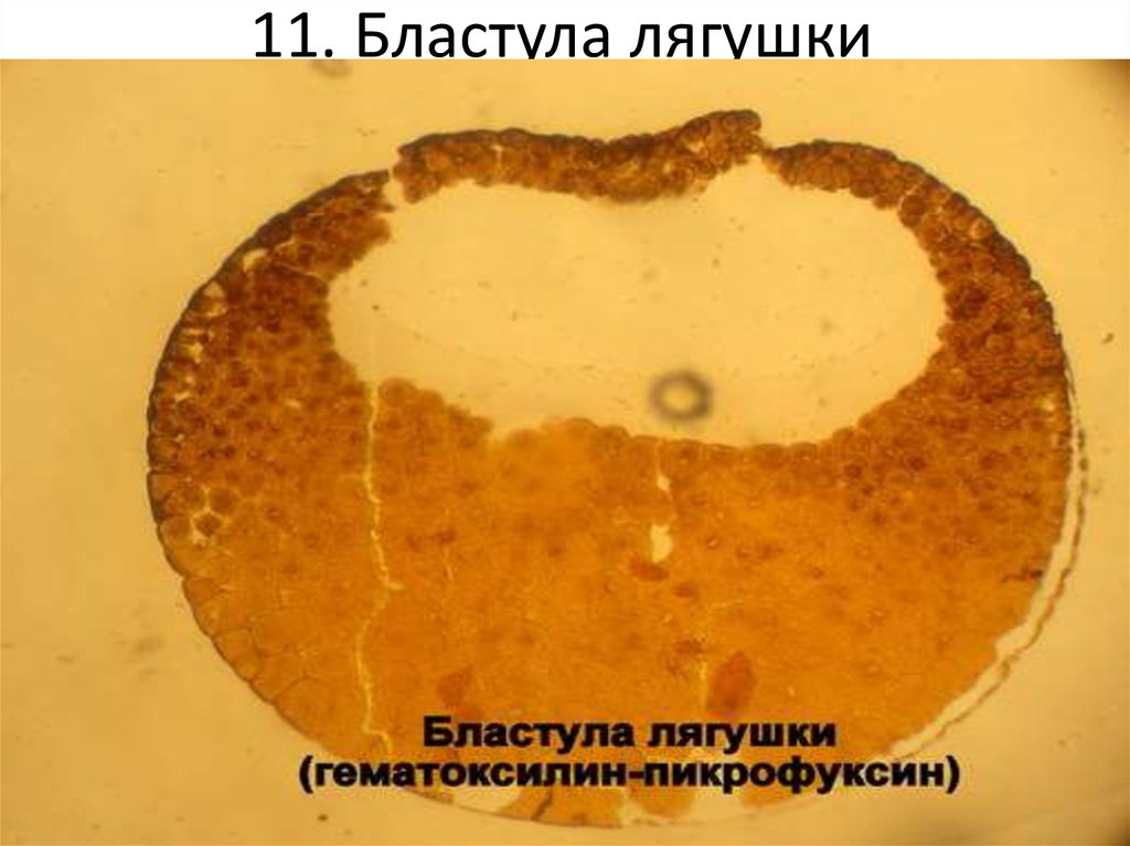 Бластула лягушки рисунок с подписями