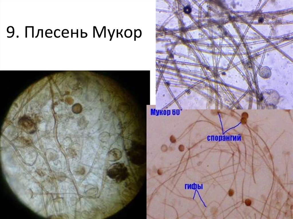 Мукор под микроскопом фото