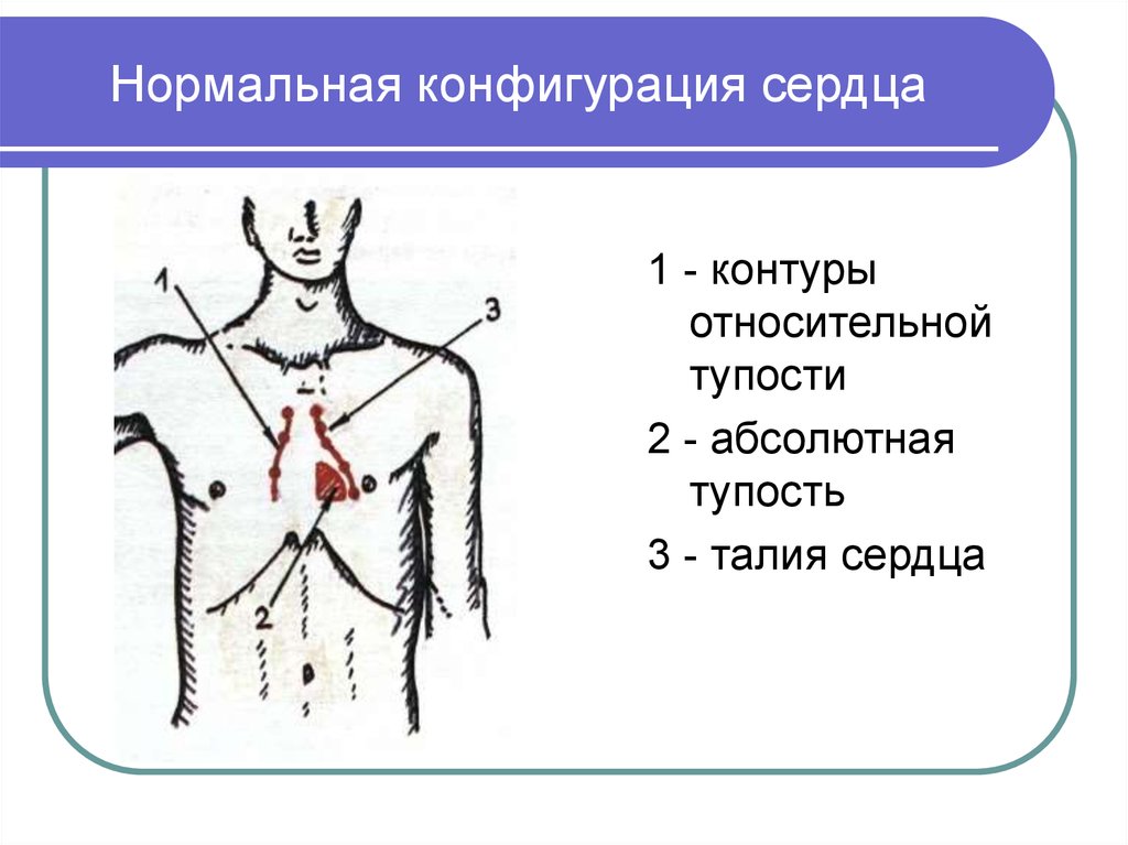 Нормальная конфигурация сердца рисунок