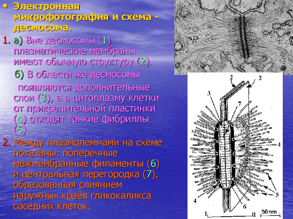 Поверхностные клетки. Десмосома микрофотография. Десмосома состав. Тонофибриллы и десмосомы строение. Десмосомы строение кожи.