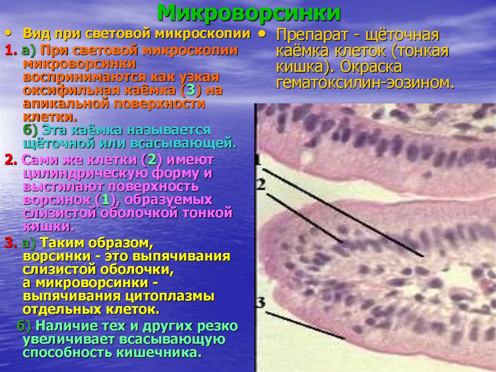 Базальные клетки. Микроворсинки гистология. Микроворсинки на эпителии слизистой. Микроворсинки гистология функции. Микроворсинки световая микроскопия.