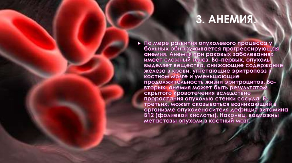 3. Анемия.