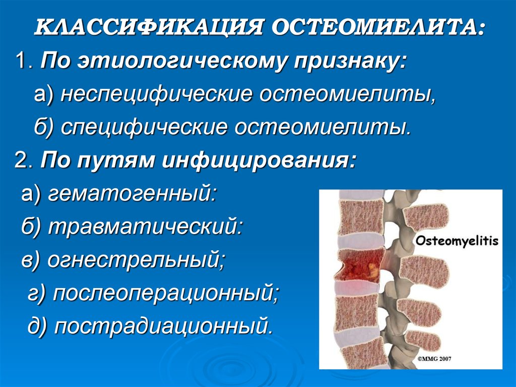 Презентация по хирургии остеомиелит