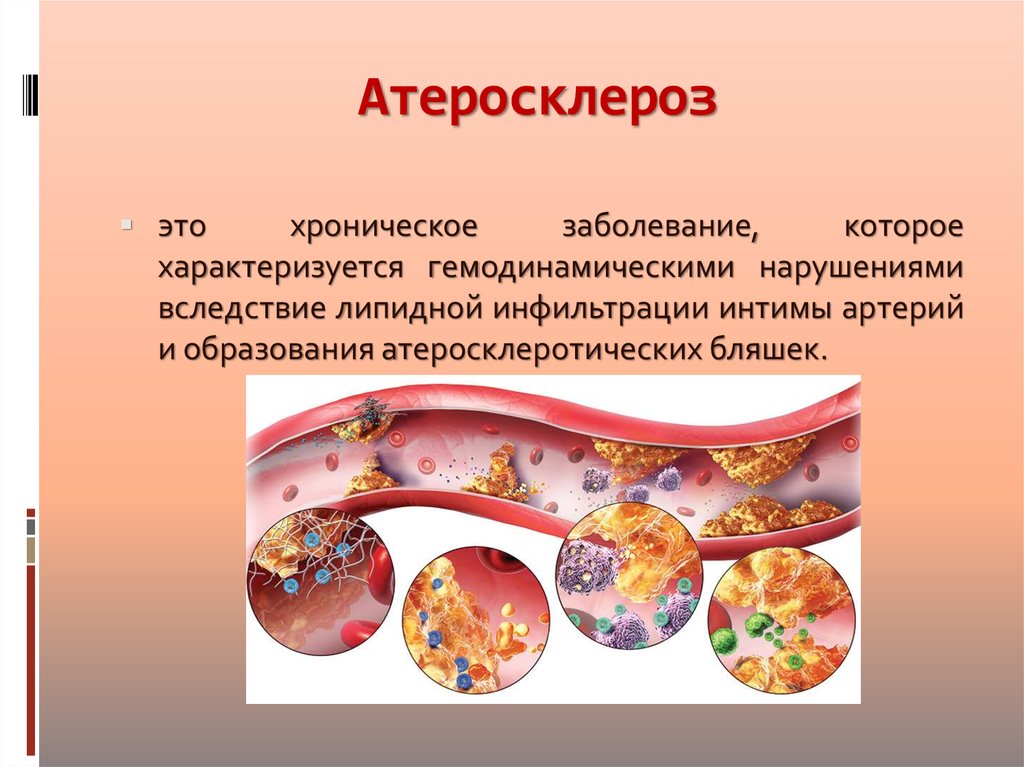 Презентация атеросклероз биохимия