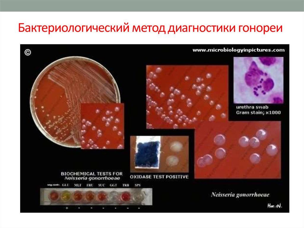 Лабораторная диагностика иппп презентация