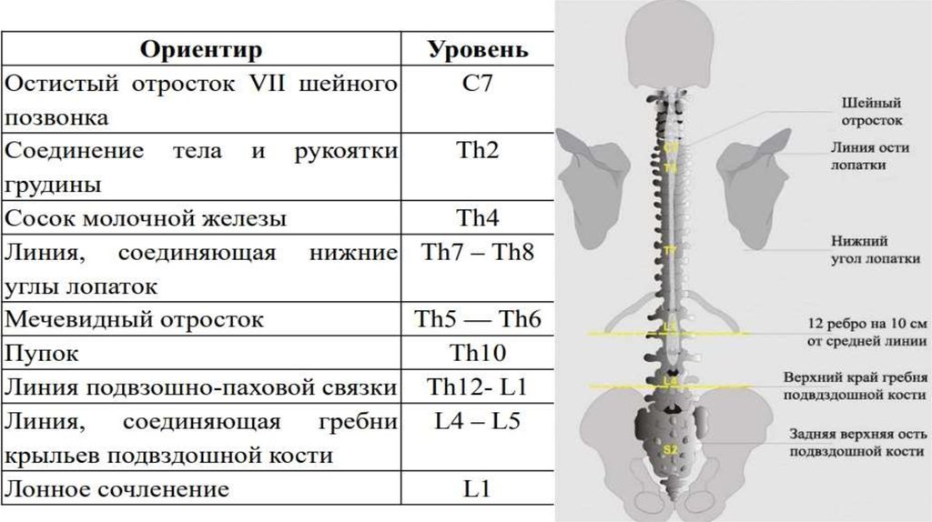 Уровни эпидуральной анестезии. Смесь Брейвика для эпидуральной анестезии. Эпидуральные электроды в позвоночнике. Эпидуральные инъекции в отдел позвоночника. Презентация эпидуральная анестезия панкреатита.