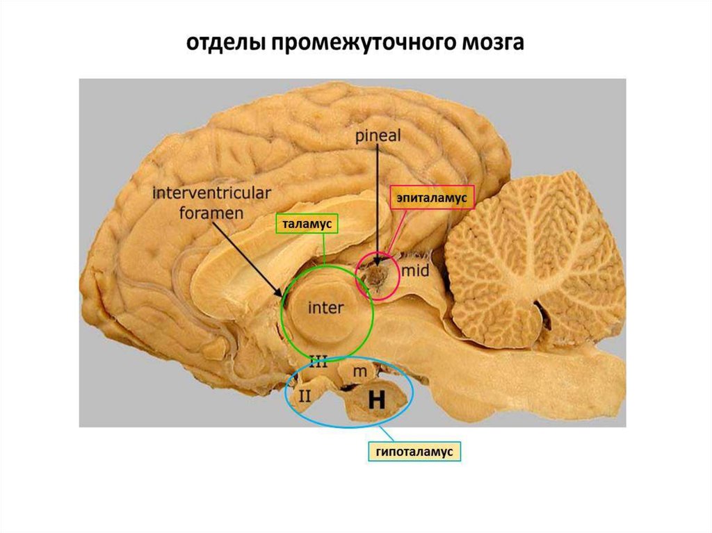 Серый мозг латынь. Промежуточный мозг мозг анатомия. 3 Желудочек головного мозга и гипоталамус. Гипоталамус препарат анатомия. Головной мозг собаки промежуточный мозг.