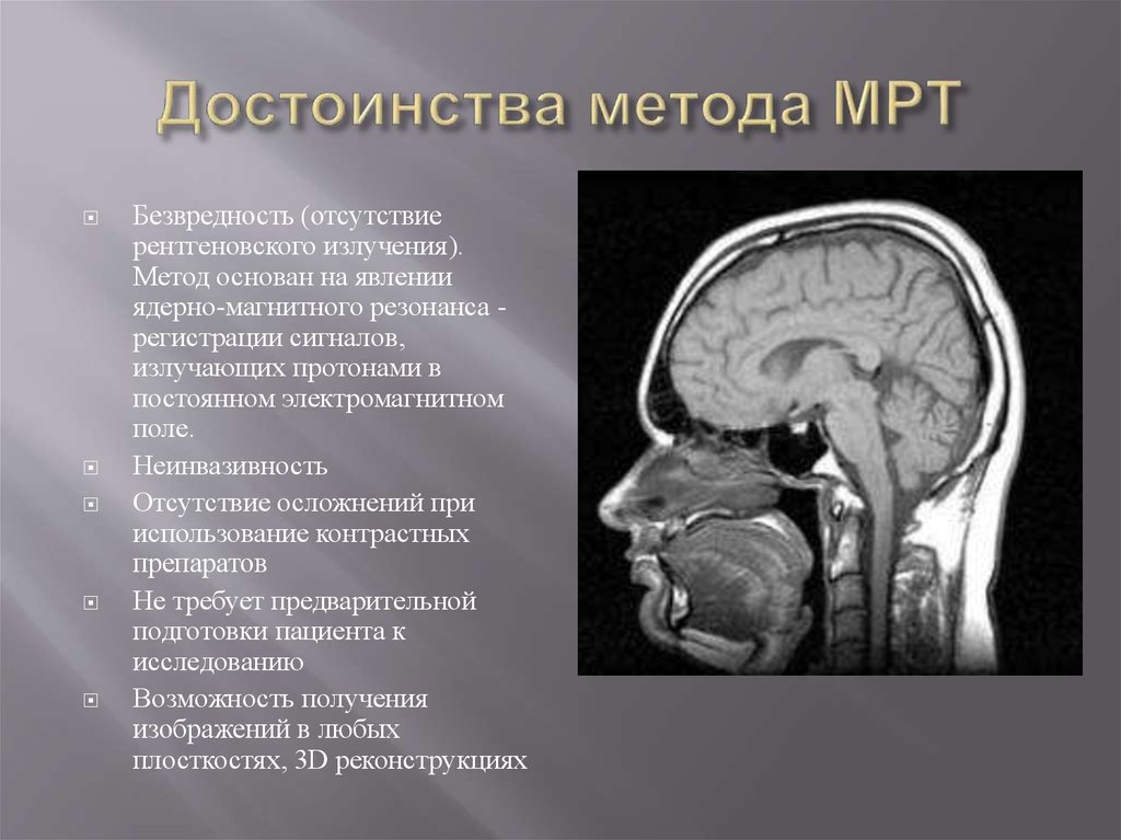 Мрт в стоматологии презентация