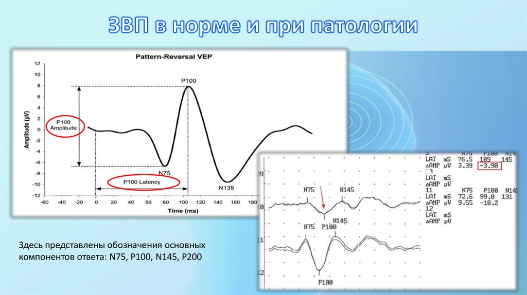 Регистрация зрительных потенциалов