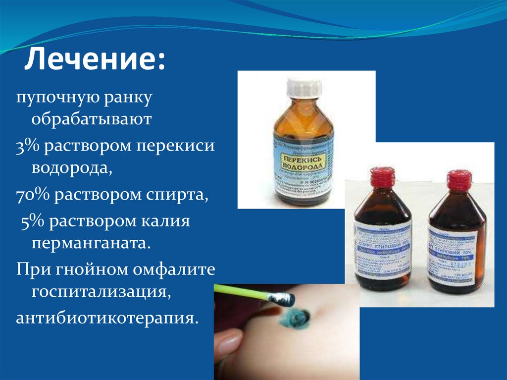 Можно ли л. Обработка пупочной ранки. Растворы для обработки пупочной ранки. Обработка пупочной ранки новорожденного. Обработка пупочной ранки спиртом.