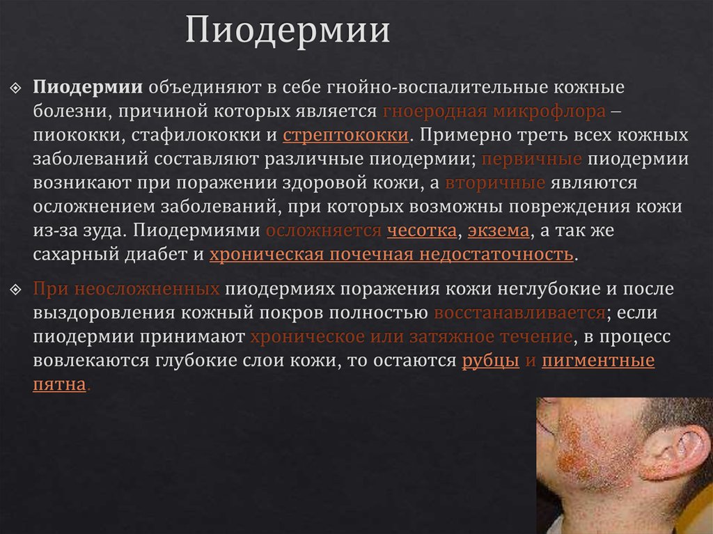 Пиодермии