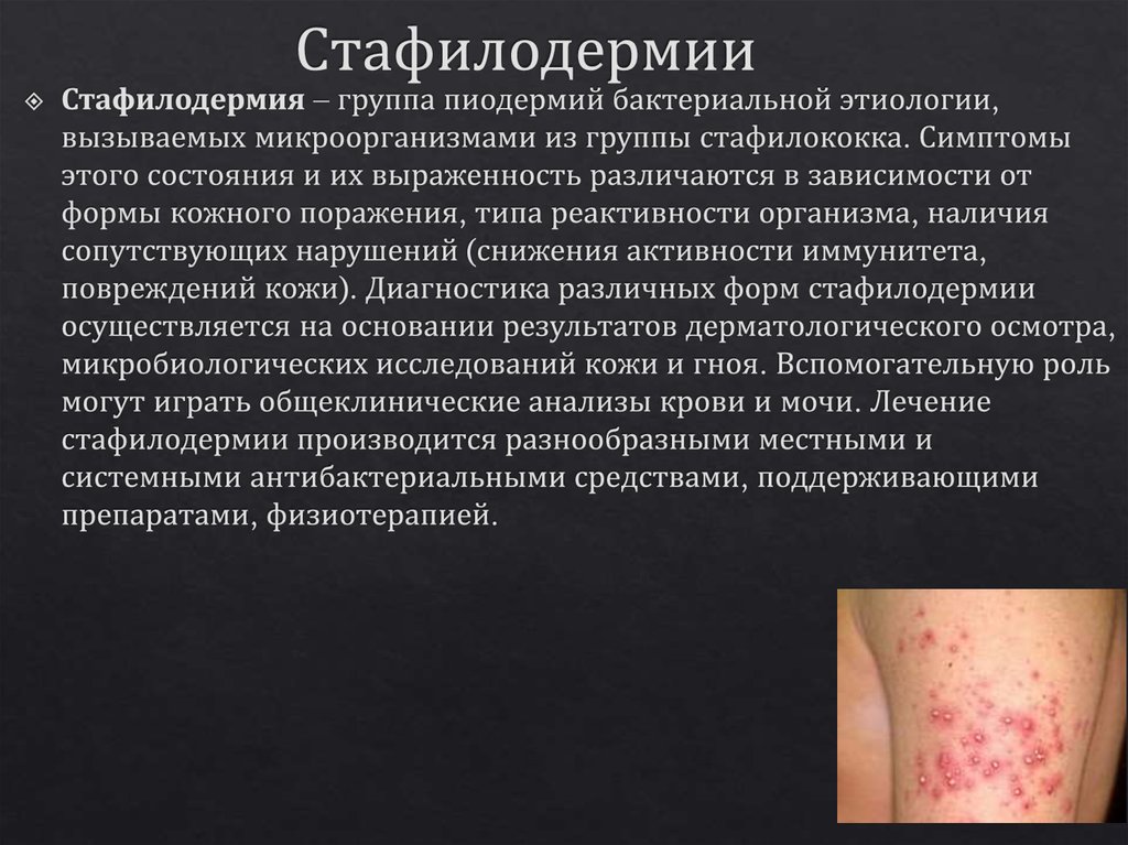 Стафилодермии