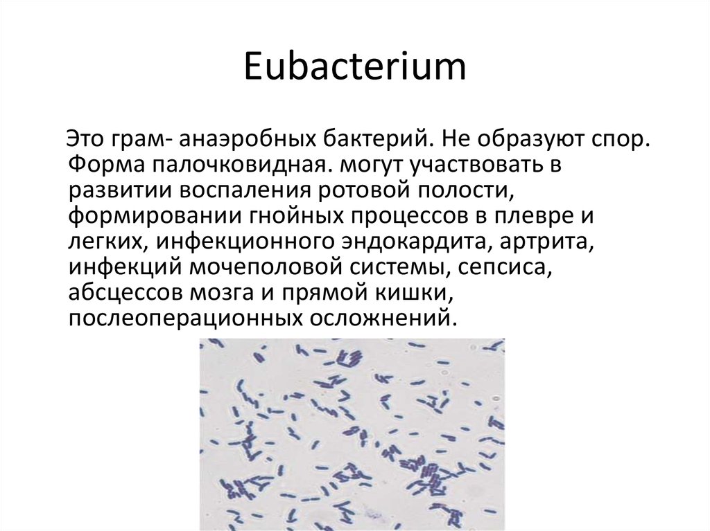 Бактерия spp. Эубактерии микробиология. Eubacterium SPP морфология. Эубактерии характеристика. Эубактерии морфология.