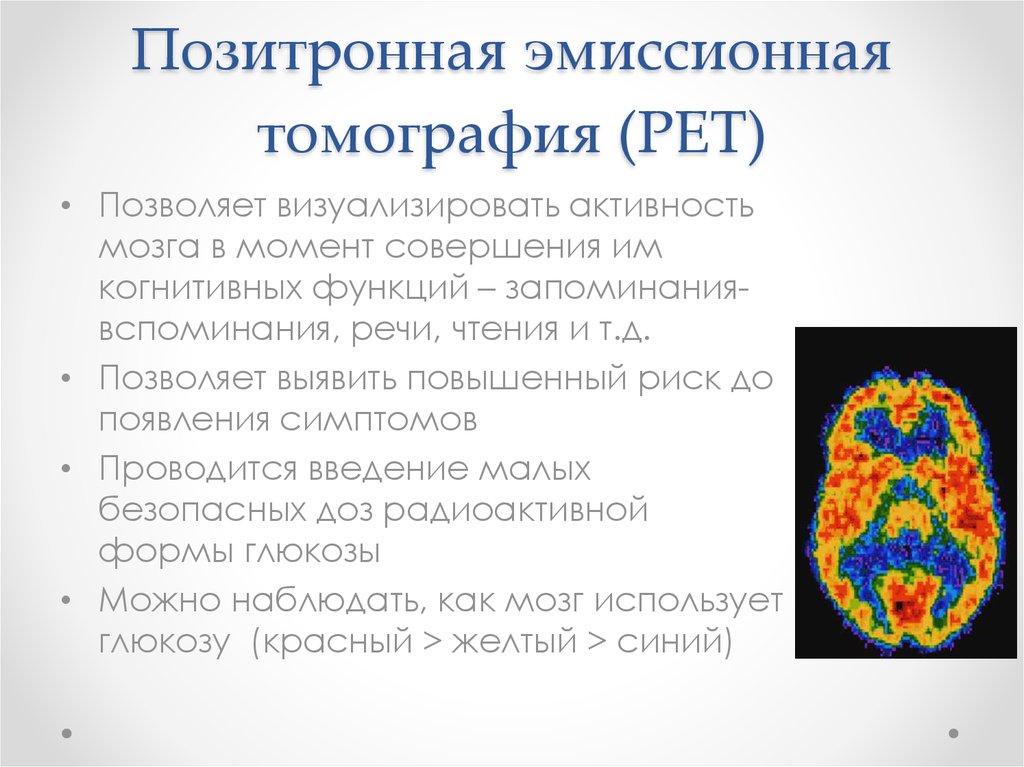 Позитронная эмиссионная томография (PET)