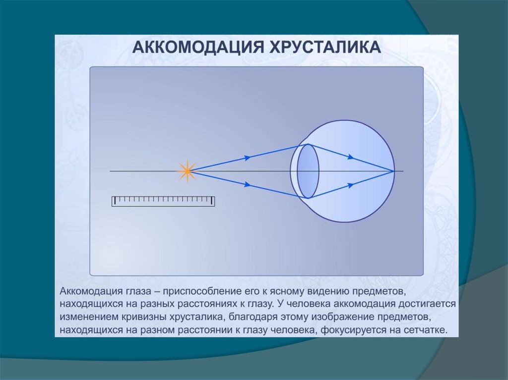 Дополните утверждения изображение в близоруком глазу