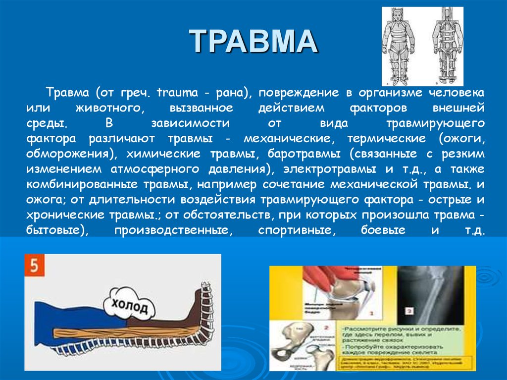 Каким видом травмы. Механические и термические травмы. Виды травмирующих факторов. Механические факторы травм.