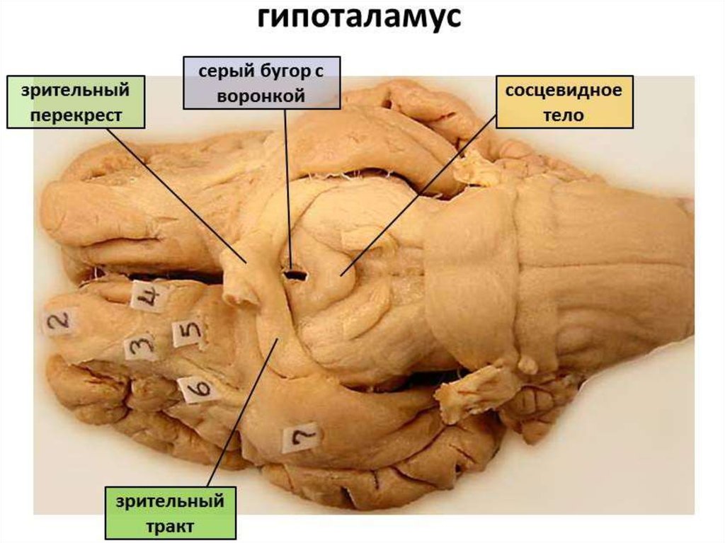 Серый мозг латынь. Гипоталамус препарат анатомия. Сосцевидные тела гипоталамуса. Зрительный Перекрест анатомия на препарате. Сосцевидное тело промежуточный мозг.